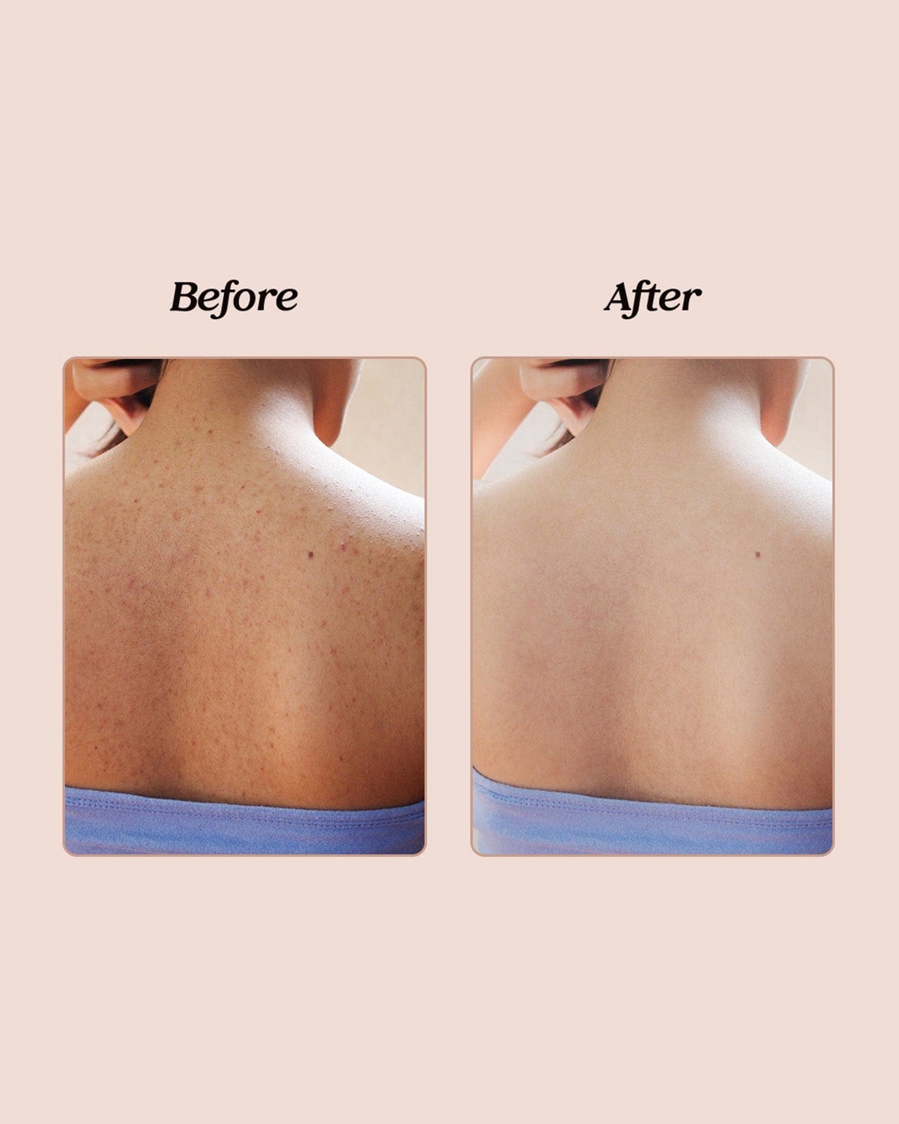 FEELITS Silk Smooth Skin Exfoliating Body Mitt